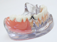 treatment_denture_02