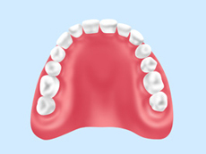 treatment_denture_05