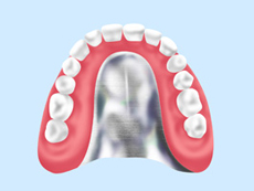 treatment_denture_06
