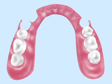 treatment_denture_07