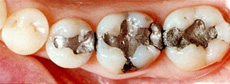 treatment_esthe_01