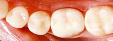 treatment_esthe_02