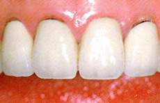 treatment_esthe_05