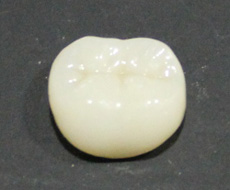 treatment_esthe_07