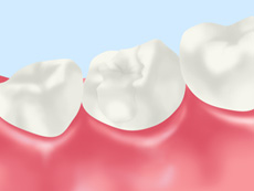 treatment_esthe_08