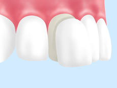 treatment_esthe_13