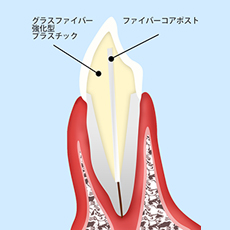 treatment_esthe_14