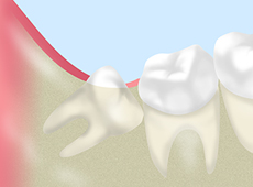 treatment_oral_surgery_03
