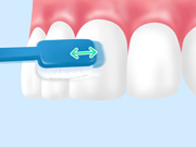 treatment_perio_06