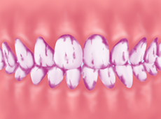 treatment_prevent_05