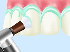 treatment_prevent_07