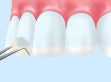 treatment_prevent_08